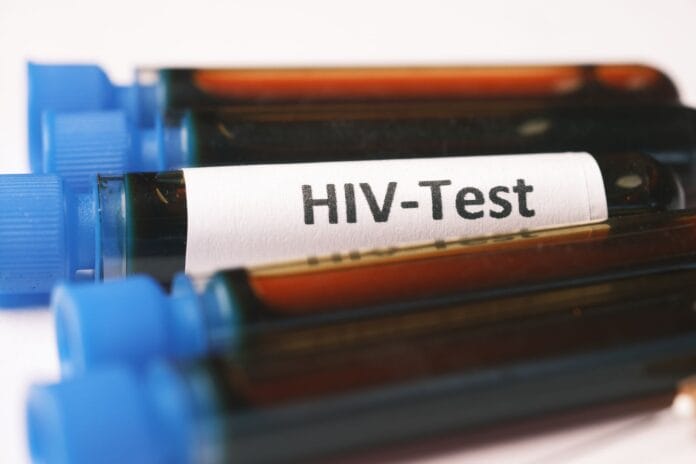 pexels-photo-10963257 blood samples for hiv test
